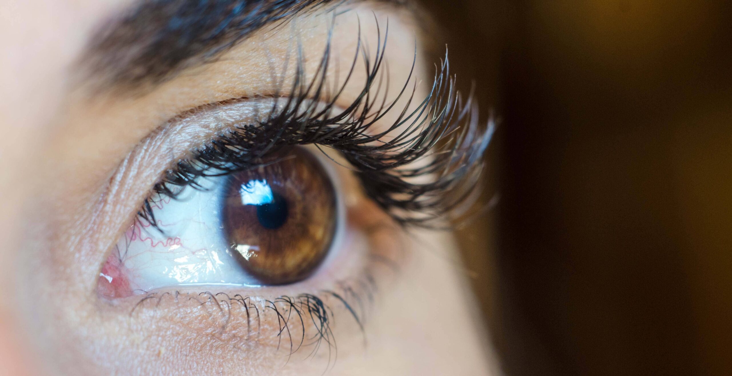 Une utilisation surprenante de l'acide hyaluronique pour traiter le regard | Dr Cormary | Lyon